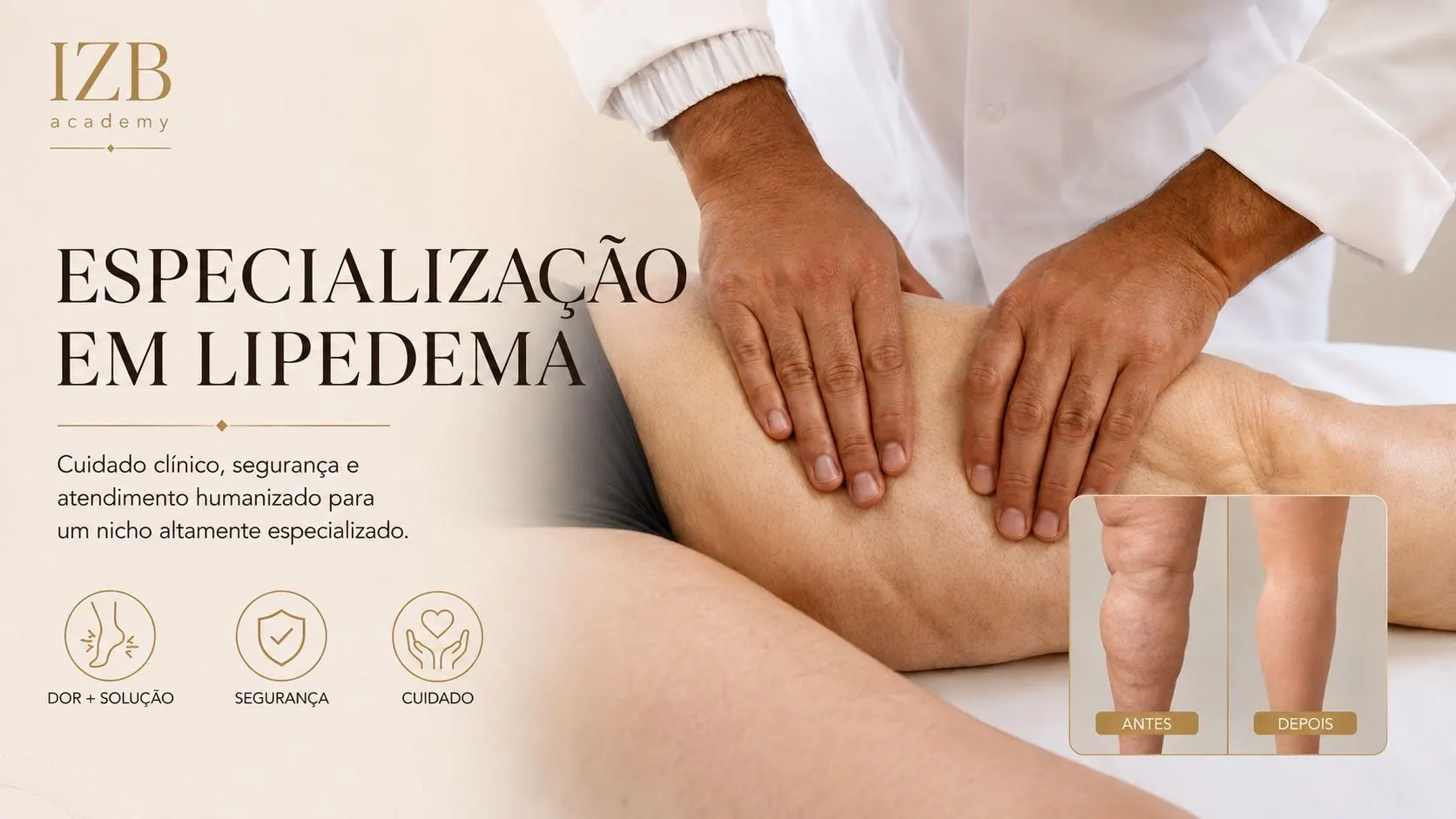 Lipedema