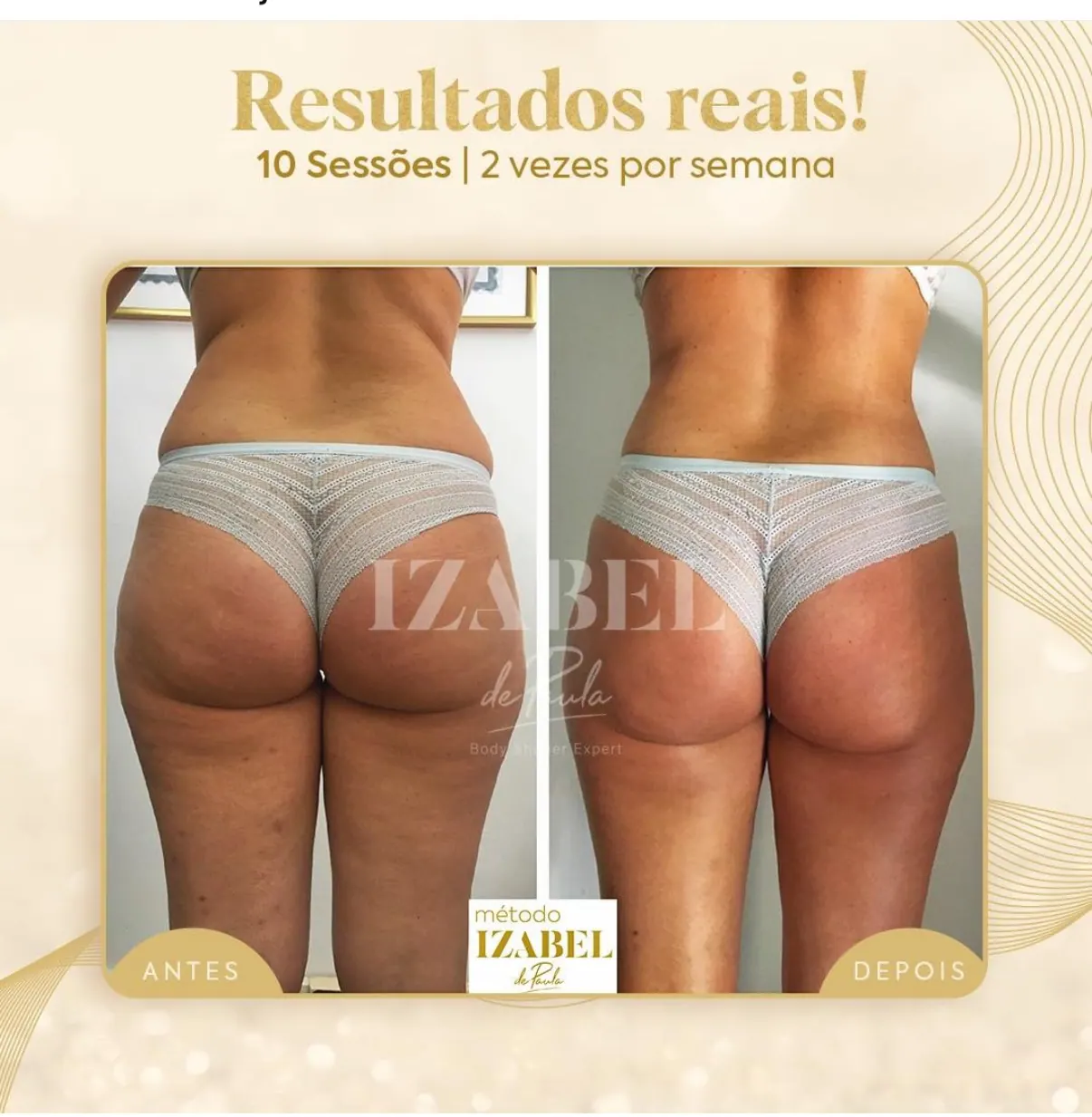 Antes e depois — 10 sessões · 2× por semana — método IZB de modelagem corporal