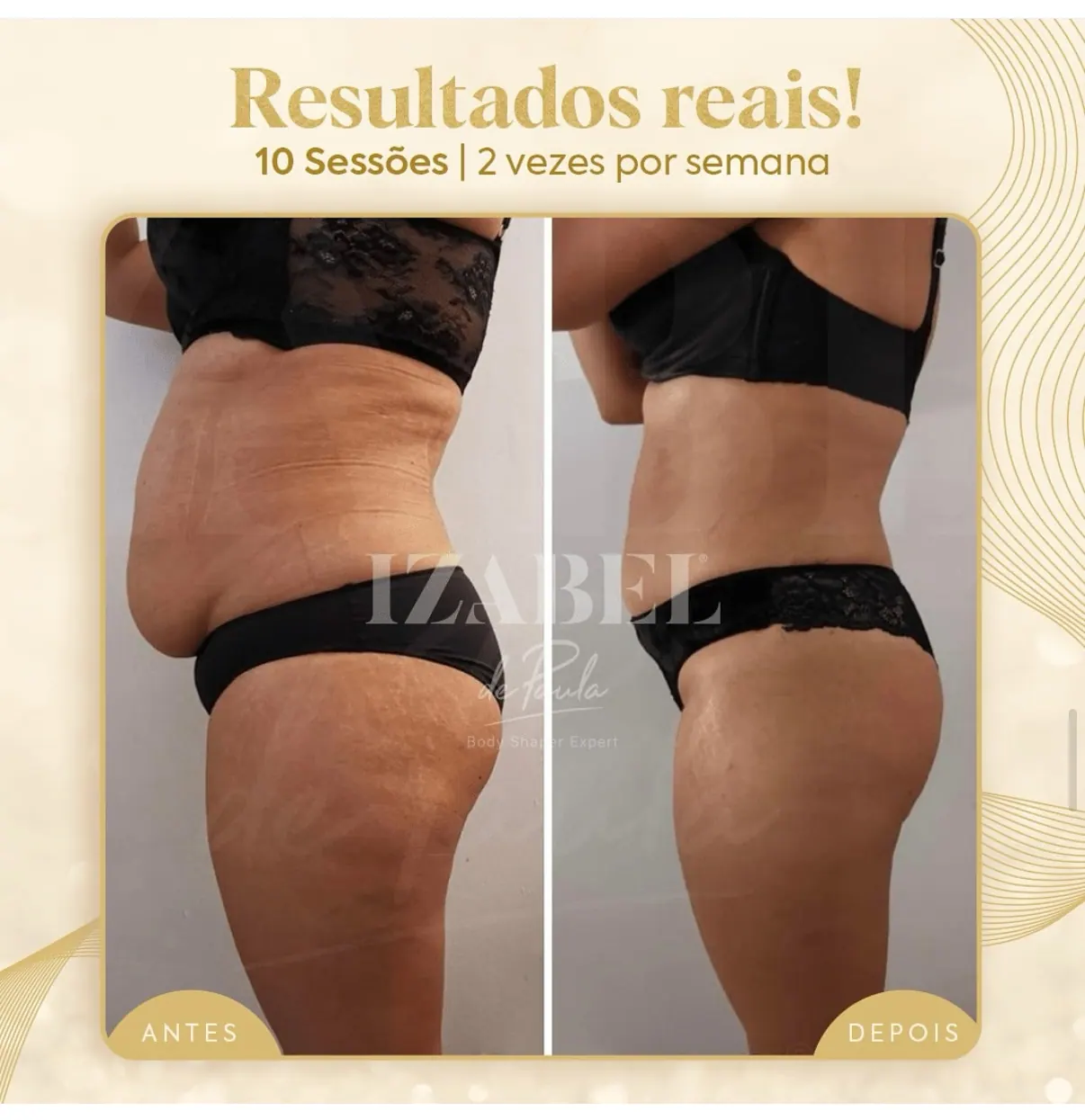 Antes e depois — 10 sessões · 2× por semana — método IZB de modelagem corporal